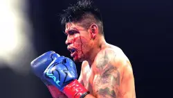Navarrete faces wild, bloody fight to stay champion; Muratalla has easier path